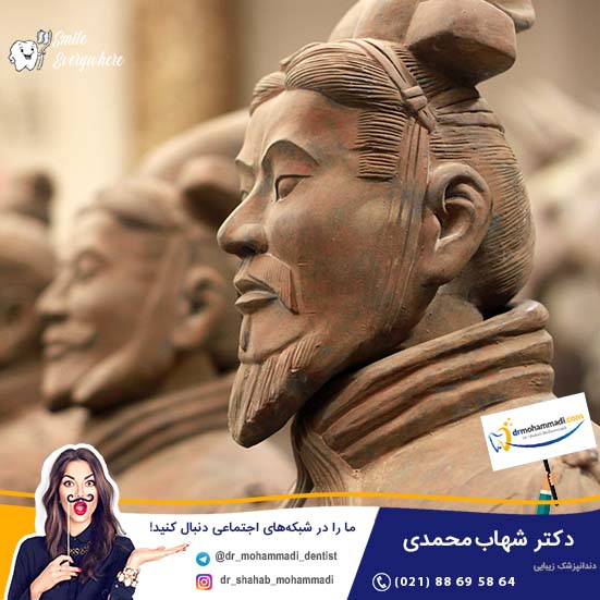 تاریخچه ایمپلنت در چین باستان - کلینیک دندانپزشکی دکتر شهاب محمدی