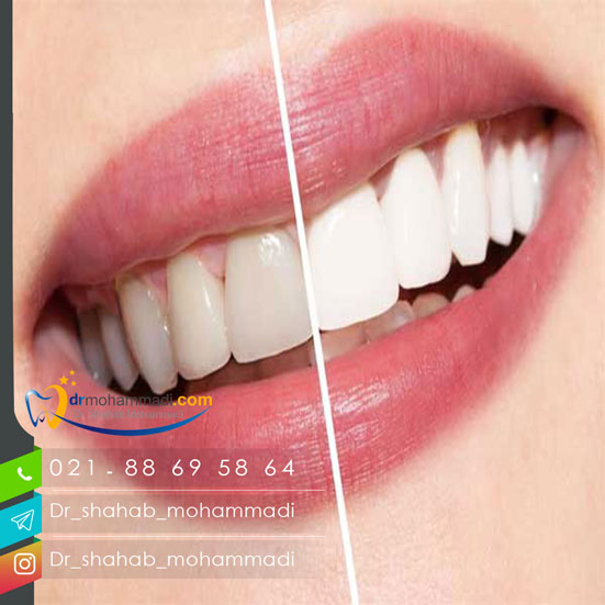 دندان از چه قسمت هایی تشکیل شده است؟ انواع دندان و عملکرد آنها