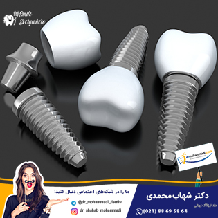 روش خارج کردن ایمپلنت دندان ناموفق - کلینیک دندانپزشکی دکتر شهاب محمدی