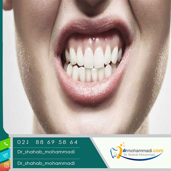 تاثیر استرس بر سلامت دندان ها