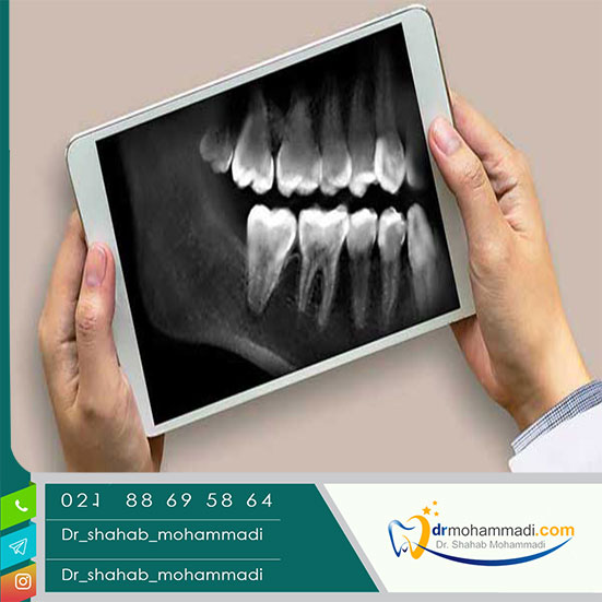 همه چیز درباره مراحل تصویربرداری در ارتودنسی