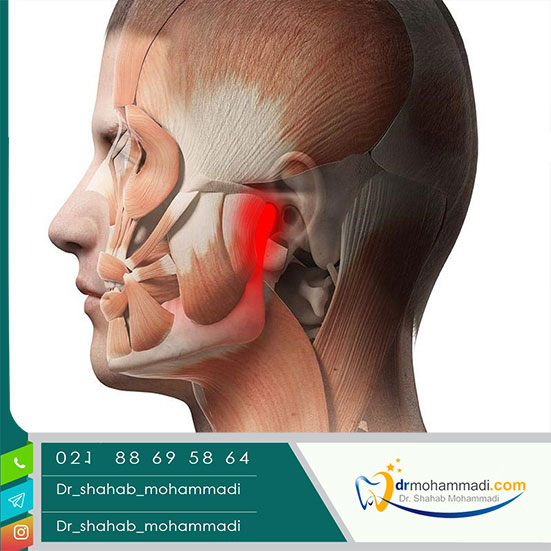 مفصل فکی گیجگاهی و مشکلات آن