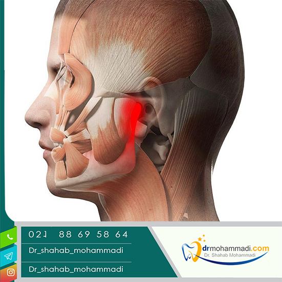 اختلالات مفصل فکی گیجگاهی-درمان و علل