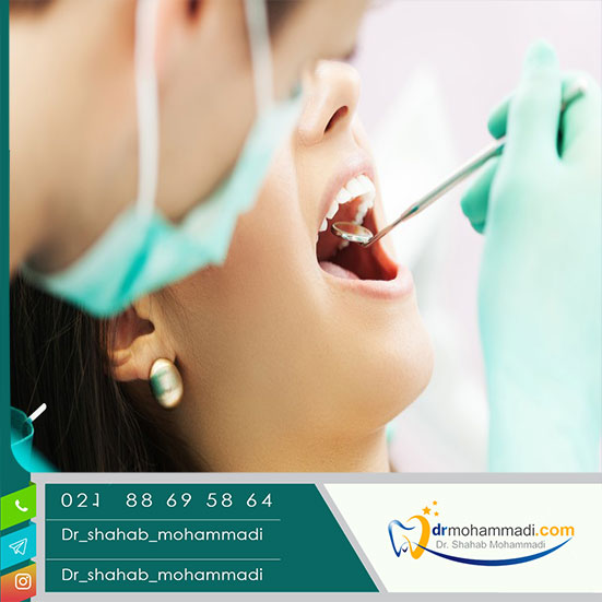 معرفی بهترین مرکز ایمپلنت دندان در تهران