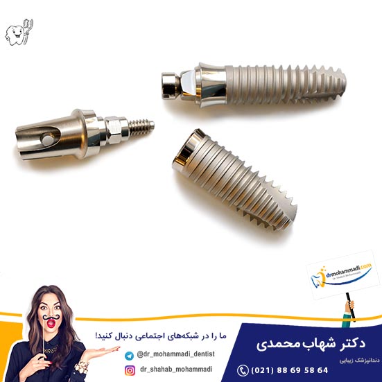 عوارض جانبی استفاده از ایمپلنت نامرغوب چیست؟ - کلینیک دندانپزشکی دکتر شهاب محمدی