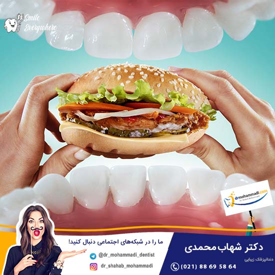 پس از کاشت ایمپلنت مراقب رژیم غذایی خود باشید - کلینیک دندانپزشکی دکتر شهاب محمدی
