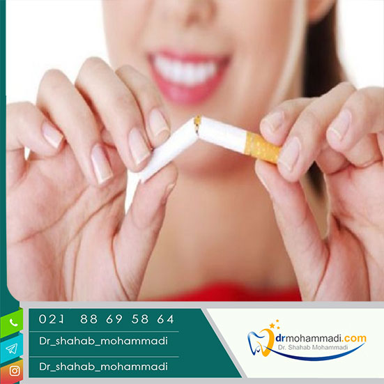 تاثیر سیگار کشیدن روی ایمپلنت های دندانی