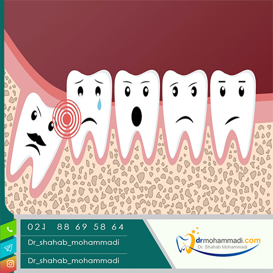 درد دندان عقل به کجا می زند؟