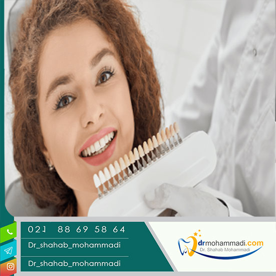 کامپوزیت بهتر است یا لمینت؟