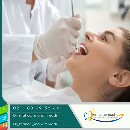 معرفی بهترین مرکز ایمپلنت دندان در تهران