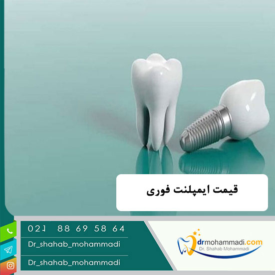 قیمت ایمپلنت دندان