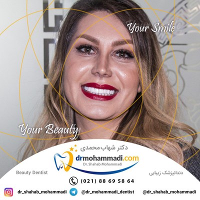 ونیر طرح لبخند