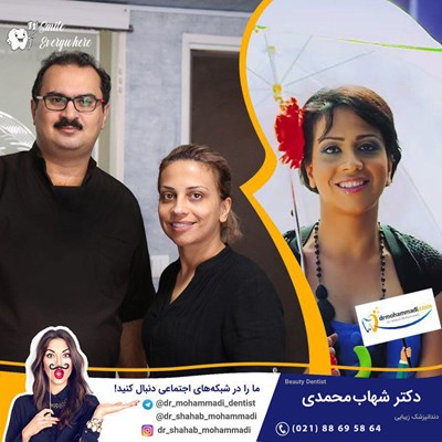 کامپوزیت ونیر طرح لبخند بدون تراش خواننده محبوب