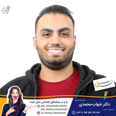 کامپوزیت ونیر طرح لبخند بدون تراش