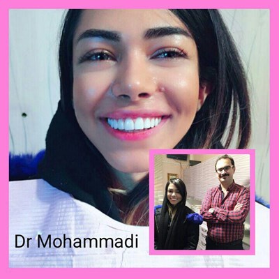 ونیر طرح لبخند