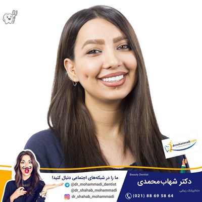 کامپوزیت ونیر طرح لبخند بدون تراش