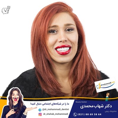 کامپوزیت ونیر طرح لبخند بدون تراش