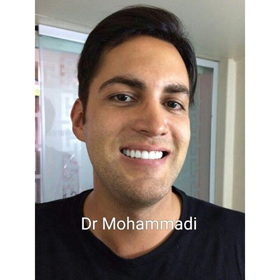 ونیر طرح لبخند