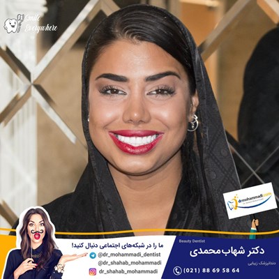 کامپوزیت ونیر طرح لبخند بدون تراش