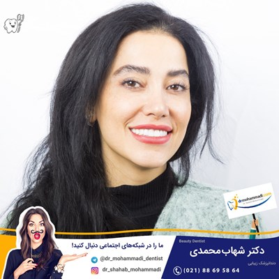 کامپوزیت ونیر طرح لبخند بدون تراش