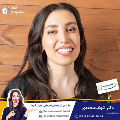 کامپوزیت ونیر طرح لبخند