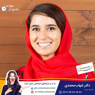 کامپوزیت ونیر طرح لبخند