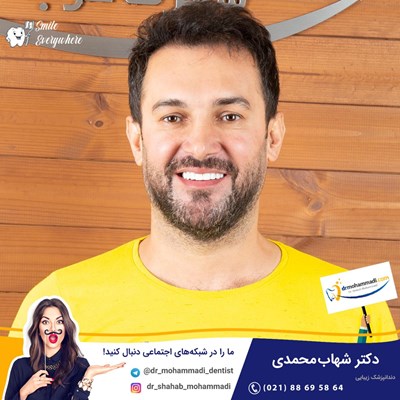 کامپوزیت ونیر طرح لبخند