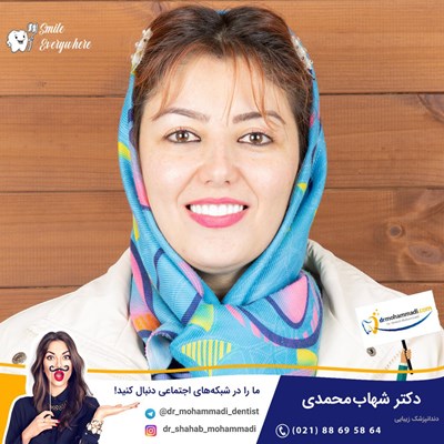 کامپوزیت ونیر نانو طرح لبخند