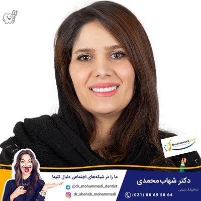 کامپوزیت ونیر نانو طرح لبخند