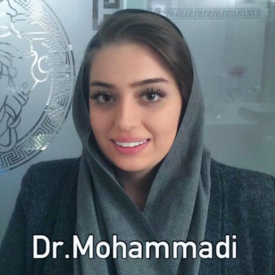 ونیر طرح لبخند