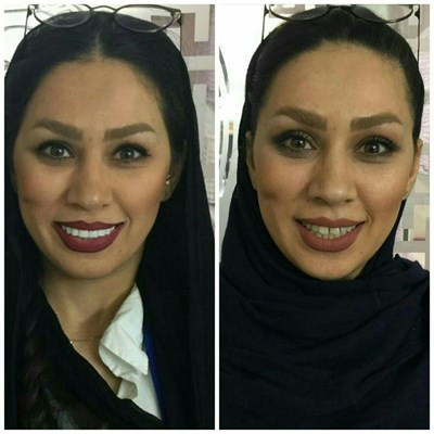 ونیر طرح لبخند