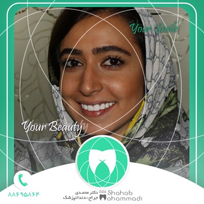 ونیر طرح لبخند