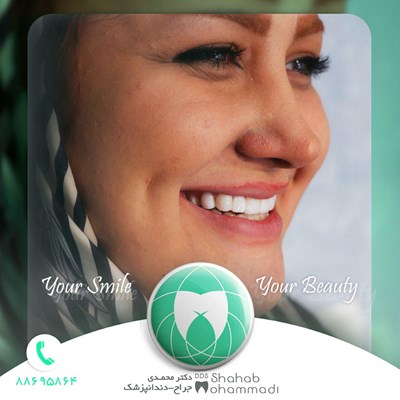 ونیر طرح لبخند