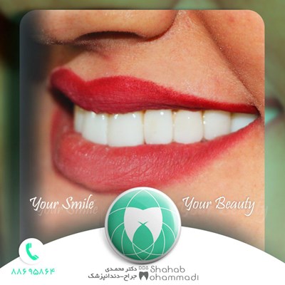 ونیر طرح لبخند