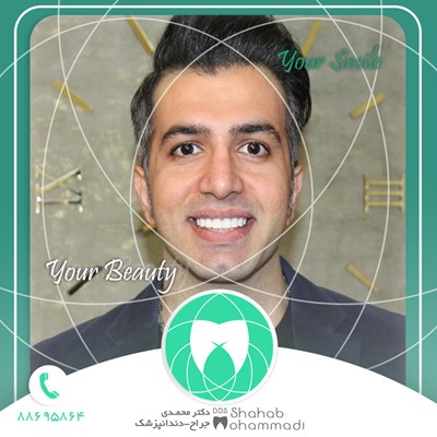 ونیر طرح لبخند