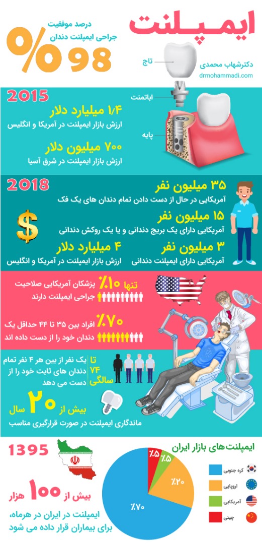 آمار اینوگرافیک ایمپلنت دندان