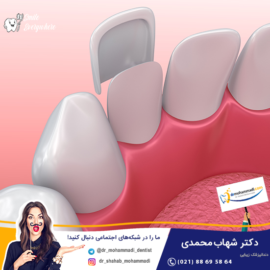 لمینیت چیست