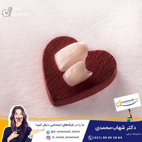 بهترین مارک لیمنت دندان