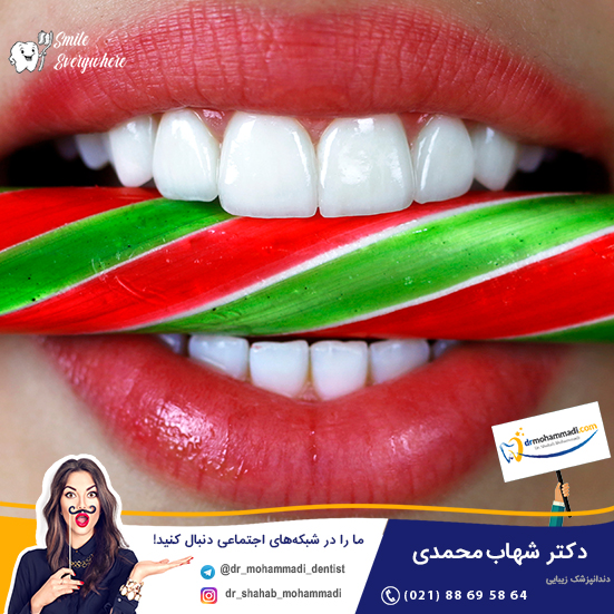 روش ساخت لمینت سرامیکی و نحوه تراش دندان برای لمینیت چگونه است؟