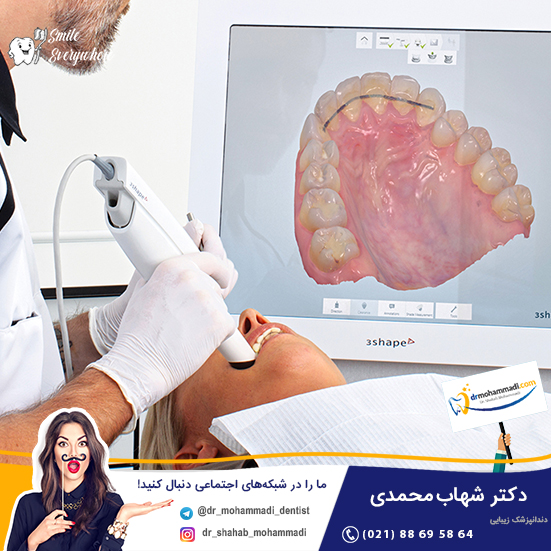 ایمپلنت دیجیتال
