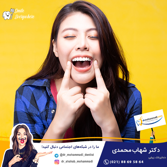 لبخند لثه ای