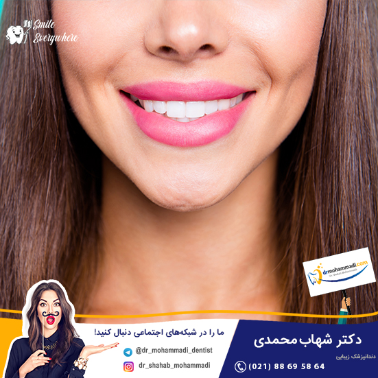 کامپوزیت دندان